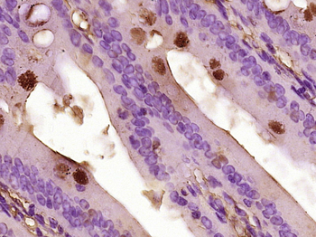 CCL26 Rabbit Polyclonal Antibo