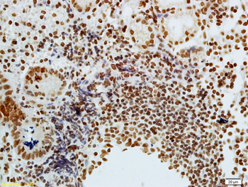 Phospho-CDKN1A/p21 (Thr57) Rab