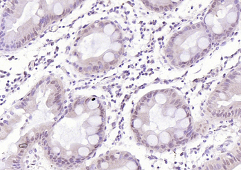 CDK6 Rabbit Polyclonal Antibod