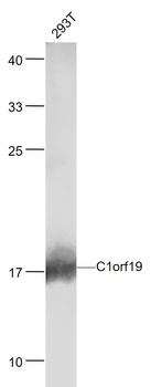 TSEN15/C1orf19 Rabbit Polyclon