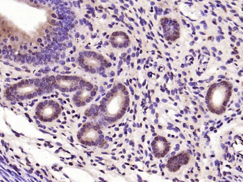 NFKB p65 Rabbit Polyclonal Ant