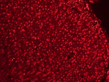 CLK2 Rabbit Polyclonal Antibod