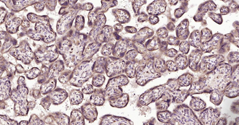 MMP12 Rabbit Polyclonal Antibo