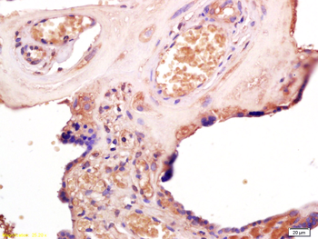 TLR3 Rabbit Polyclonal Antibod
