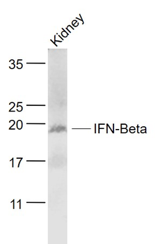 IFNB1 Rabbit Polyclonal Antibo