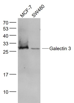 Galectin 3 Mouse Monoclonal An