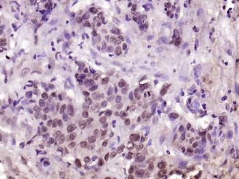 Phospho-YAP1 (Tyr407) Rabbit P