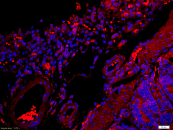 Caspase-6 subunit p18 Rabbit P