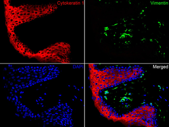 Cytokeratin 1 Recombinant Rabb