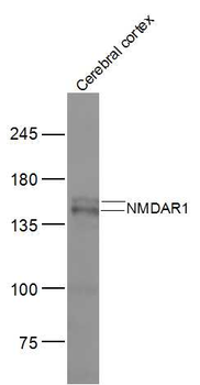 NMDAR1 Rabbit Polyclonal Antib