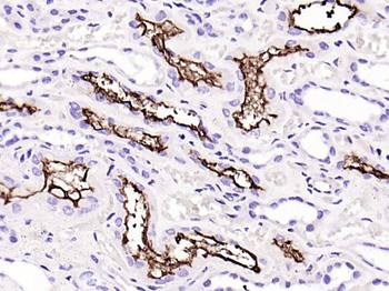 ACE2 Recombinant Rabbit Monocl