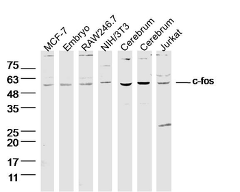 C-fos Rabbit Polyclonal Antibo