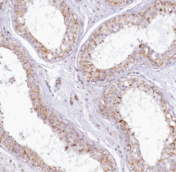 ADAM5 Antibody抗体,orb624496,bio