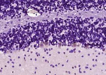 KIF3A Rabbit Polyclonal Antibo