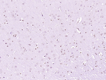 Phospho-DDX5 (Tyr593) Rabbit P