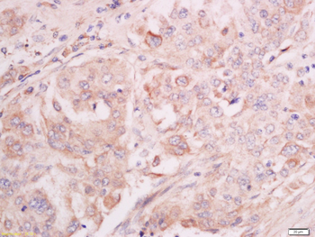 Mst2 Rabbit Polyclonal Antibod