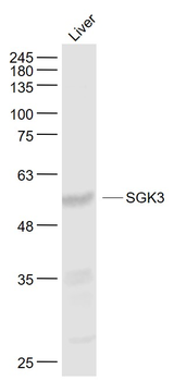 SGK3 Rabbit Polyclonal Antibod
