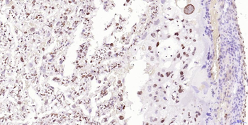 Phospho-H2AX (Ser139) Recombin