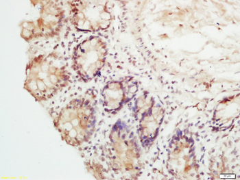 RFC1 Rabbit Polyclonal Antibod