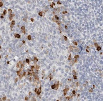 AKNA Antibody抗体，orb624592，bior