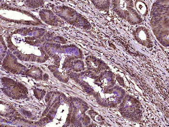 Galectin 3 Mouse Monoclonal An