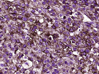 TRP2 Rabbit Polyclonal Antibod