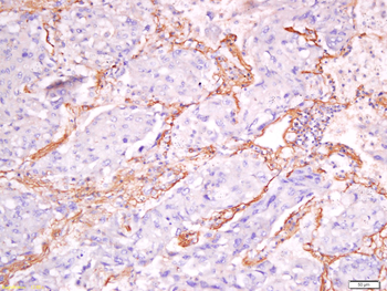 Exportin-2 Rabbit Polyclonal A