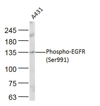Phospho-EGFR (Ser991) Rabbit P
