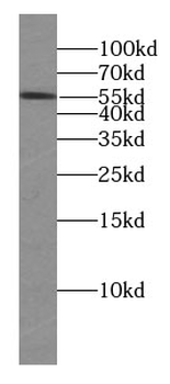 HDAC2 Antibody抗体,orb395116,bio