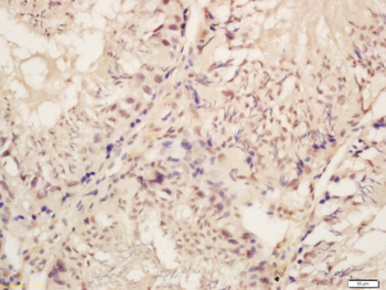 Phospho-BRAF (Ser446) Rabbit P