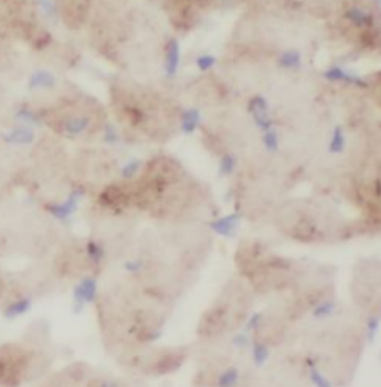 ST8SIA2 Antibody抗体，orb395615，b