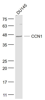 CCN1 Rabbit Polyclonal Antibod