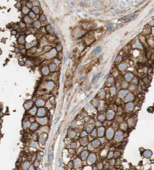 HDAC2 Antibody抗体,orb395116,bio