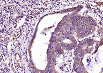 SLC15A1 Rabbit Polyclonal Anti