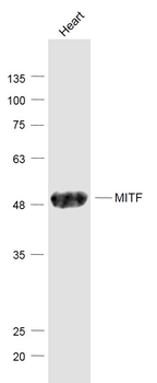 MITF Rabbit Polyclonal Antibod
