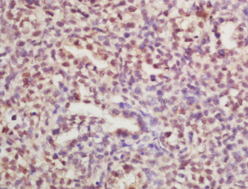 RPLP0 Rabbit Polyclonal Antibo