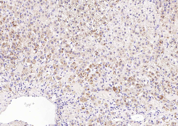 TM7SF2 Rabbit Polyclonal Antib