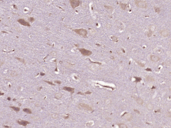 Mu Opioid receptor Rabbit Poly