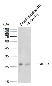 CIDEB Rabbit Polyclonal Antibo