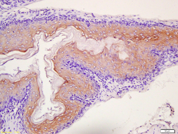 TPM2 Rabbit Polyclonal Antibod