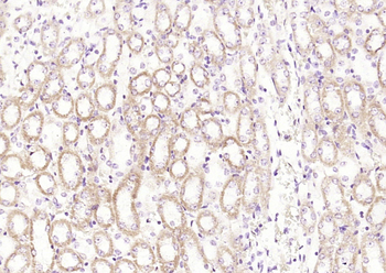 Cathepsin H Rabbit Polyclonal