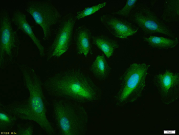 P53 (wt-p53) Rabbit Polyclonal