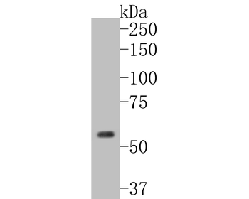Cytokeratin 5 Recombinant Rabb