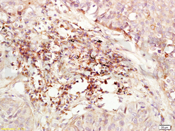 CXCR4 Rabbit Polyclonal Antibo