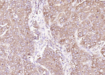 Calreticulin Mouse Monoclonal