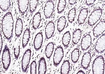 Phospho-Crkl (Tyr251) Rabbit P