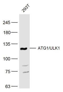 ATG1/ULK1 Rabbit Polyclonal An