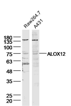 ALOX12 Rabbit Polyclonal Antib