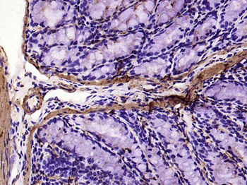 Alpha smooth muscle Actin Reco