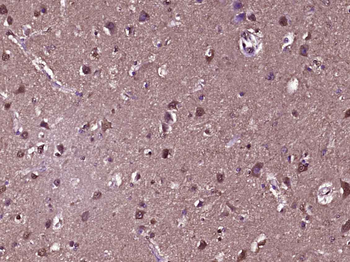 Galectin 3 Mouse Monoclonal An